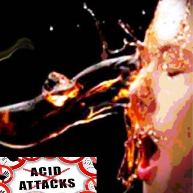 लखनऊ में सरेराह छात्रा पर Acid  Attack